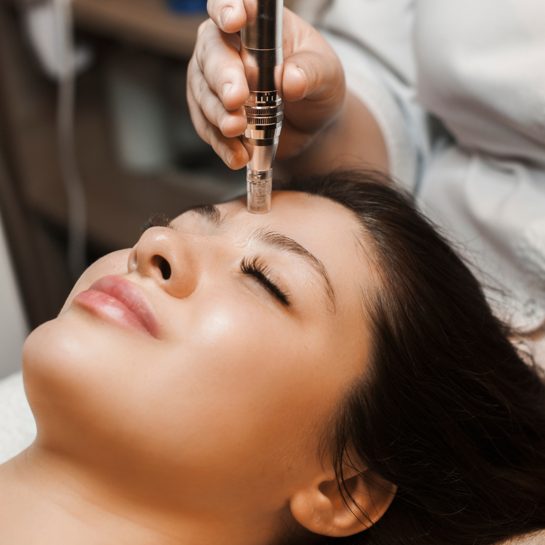 Microneedling