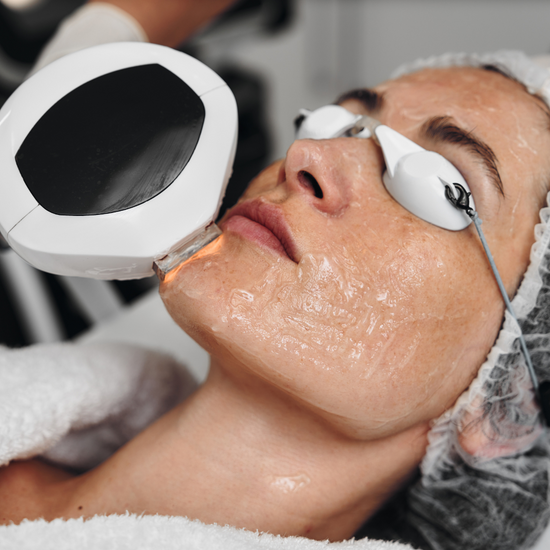 Anti-Aging mit High-Tech: So funktioniert die IPL-Lichttherapie – und warum sie mehr kann als du denkst