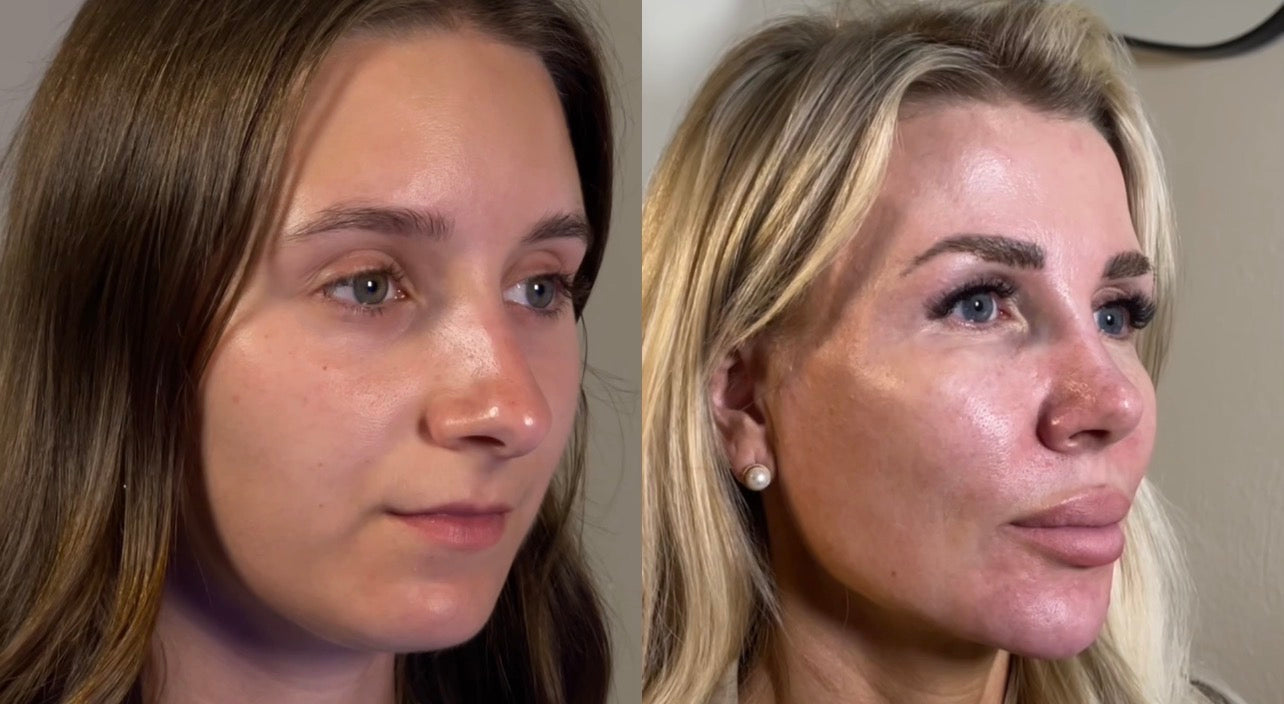 Laden Sie das Video: 